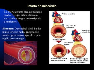 Infarto do miocárdio
É a morte de uma área do músculo
cardíaco, cujas células ficaram
sem receber sangue com oxigênio
e nutrientes.
Sintomas: O principal sinal é a dor
muito forte no peito, que pode se
irradiar pelo braço esquerdo e pela
região do estômago.
 