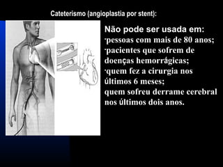 Cateterismo (angioplastia por stent):
Não pode ser usada em:
•pessoas com mais de 80 anos;
•pacientes que sofrem de
doenças hemorrágicas;
•quem fez a cirurgia nos
últimos 6 meses;
quem sofreu derrame cerebral
nos últimos dois anos.
 