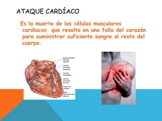 ATAQUE CARDÍACO
Es la muerte de las células musculares
cardiacas que resulta en una falla del corazón
para suministrar suficiente sangre al resto del
cuerpo.
 