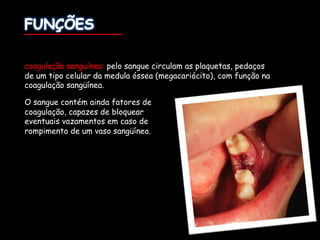 coagulação sanguínea: pelo sangue circulam as plaquetas, pedaços
de um tipo celular da medula óssea (megacariócito), com função na
coagulação sangüínea.
O sangue contém ainda fatores de
coagulação, capazes de bloquear
eventuais vazamentos em caso de
rompimento de um vaso sangüíneo.
 