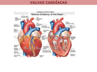 VALVAS CARDÍACAS
 