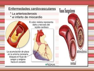Enfermedades cardiovasculares *  La  arteriosclerosis *  el  infarto de miocardio 