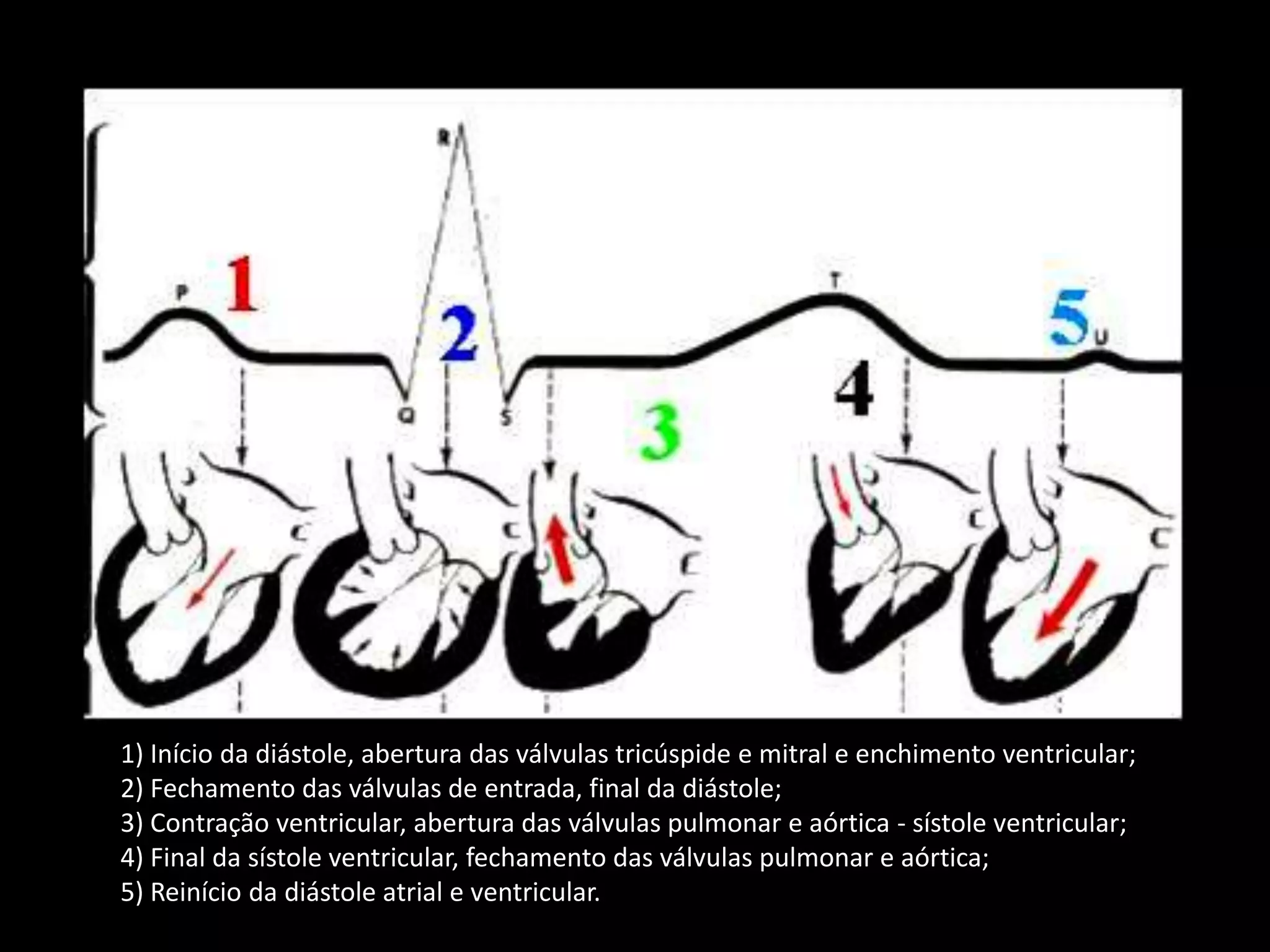 1) Início da diástole, abertura das válvulas tricúspide e mitral e enchimento ventricular; 2) Fechamento das válvulas de entrada, final da diástole; 3) Contração ventricular, abertura das válvulas pulmonar e aórtica - sístole ventricular; 4) Final da sístole ventricular, fechamento das válvulas pulmonar e aórtica; 5) Reinício da diástole atrial e ventricular. 