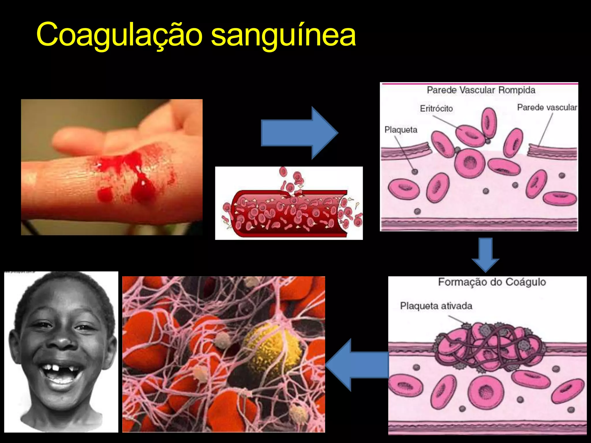 Coagulação sanguínea