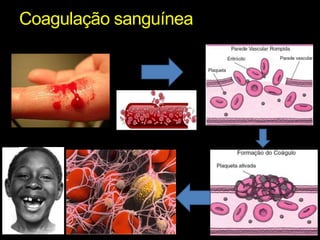 Coagulação sanguínea