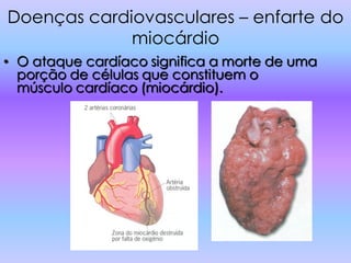 Doenças cardiovasculares – enfarte do
             miocárdio
• O ataque cardíaco significa a morte de uma
  porção de células que constituem o
  músculo cardíaco (miocárdio).
 