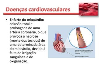 • Enfarte do miocárdio:
  oclusão total e
  prolongada de uma
  artéria coronária, o que
  provoca a necrose
  (morte dos tecidos) de
  uma determinada área
  do miocárdio, devido à
  falta de irrigação
  sanguínea e de
  oxigenação.
 