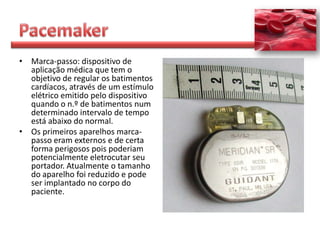 • Marca-passo: dispositivo de
  aplicação médica que tem o
  objetivo de regular os batimentos
  cardíacos, através de um estímulo
  elétrico emitido pelo dispositivo
  quando o n.º de batimentos num
  determinado intervalo de tempo
  está abaixo do normal.
• Os primeiros aparelhos marca-
  passo eram externos e de certa
  forma perigosos pois poderiam
  potencialmente eletrocutar seu
  portador. Atualmente o tamanho
  do aparelho foi reduzido e pode
  ser implantado no corpo do
  paciente.
 