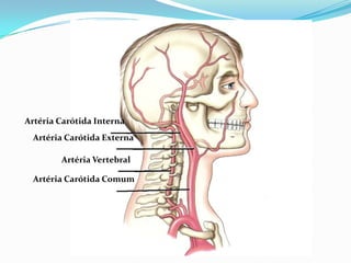 Artéria Carótida Interna
Artéria Carótida Externa
Artéria Vertebral
Artéria Carótida Comum
 