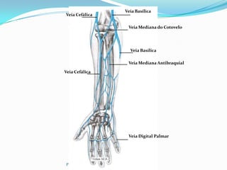 PROF ENF GLEIDSON
Veia Cefálica
Veia Cefálica
Veia Basílica
Veia Mediana do Cotovelo
Veia Basílica
Veia Mediana Antibraquial
Veia Digital Palmar
 