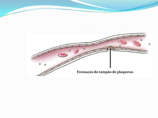 Formação do tampão de plaquetas
 