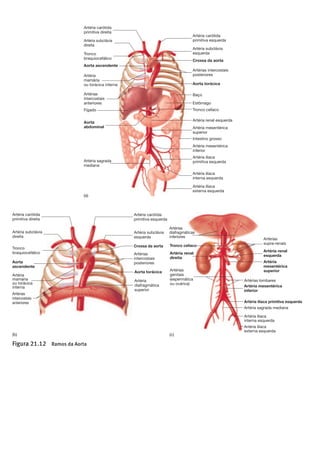 !
!
!
!
!
!
!
!
Capítulo 21 Aparelho Circulatório: Circulação e Regulação Periférica 737
Artéria carótida
primitiva esquerda
Artéria subclávia
esquerda
Crossa da aorta
Artérias
intercostais
posteriores
Aorta torácica
Artéria
diafragmática
superior
Artéria carótida
primitiva direita
Artéria subclávia
direita
Artérias
intercostais
anteriores
Artéria
mamária
ou torácica
interna
Tronco
braquiocefálico
Aorta
ascendente
Artérias
diafragmáticas
inferiores
Tronco celíaco
Artéria renal
direita
Artérias
genitais
(espermática
ou ovárica)
Artérias
supra-renais
Artéria renal
esquerda
Artéria
mesentérica
superior
Artérias lombares
Artéria mesentérica
inferior
Artéria ilíaca primitiva esquerda
Artéria sagrada mediana
Artéria ilíaca
interna esquerda
Artéria ilíaca
externa esquerda
Artéria carótida
primitiva esquerda
Artéria subclávia
esquerda
Crossa da aorta
Artérias intercostais
posteriores
Aorta torácica
Baço
Estômago
Tronco celíaco
Artéria renal esquerda
Artéria mesentérica
superior
Intestino grosso
Artéria mesentérica
inferior
Artéria ilíaca
primitiva esquerda
Artéria ilíaca
interna esquerda
Artéria ilíaca
externa esquerda
Artéria carótida
primitiva direita
Artéria subclávia
direita
Artéria sagrada
mediana
Aorta
abdominal
Fígado
Artérias
intercostais
anteriores
Artéria
mamária
ou torácica interna
Tronco
braquiocefálico
Aorta ascendente
Figura 21.12 Ramos da Aorta
(a) A aorta é dividida em três porções: aorta ascendente, crossa da aorta e aorta descendente . A aorta descendente divide-se em aorta torácica e aorta abdominal.
(b) Aorta torácica. (c) Aorta abdominal.
(a)
(b) (c)
 