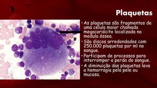 Plaquetas
• As plaquetas são fragmentos de
uma célula maior chamada
megacariócito localizada na
medula óssea.
• São discos arredondados com
250.000 plaquetas por ml no
sangue.
• Participam de processos para
interromper a perda do sangue.
• A diminuição das plaquetas leva
a hemorragia pela pele ou
mucosa.
 