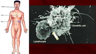 Órgãos Linfáticos
• O baço, os linfonódos (nódulos linfáticos), as
tonsilas palatinas (amígdalas), a tonsila faríngea
(adenóides) e o timo (tecido conjuntivo reticular
linfóide rico em linfócitos) são órgãos do
sistema linfático.
• Estes órgãos contém uma estrutura que suporta
a circulação dos linfócitos A e B e outras células
imunológicas tais como os macrófagos e células
dendríticas.
 