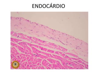 ENDOCÁRDIO
 
