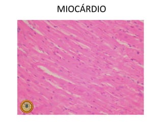 MIOCÁRDIO
 