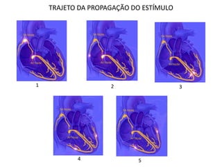 TRAJETO DA PROPAGAÇÃO DO ESTÍMULO
1 2 3
4 5
 