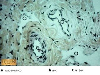 a VASO LINFÁTICO b VEIA C ARTÉRIA
 