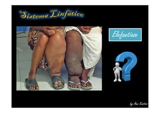 ElefantíaseElefantíase
by Ana Kastro
 