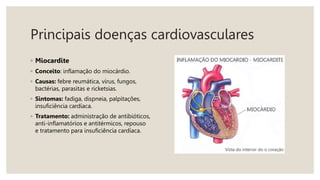 Principais doenças cardiovasculares
◦ Miocardite
◦ Conceito: inflamação do miocárdio.
◦ Causas: febre reumática, vírus, fungos,
bactérias, parasitas e ricketsias.
◦ Sintomas: fadiga, dispneia, palpitações,
insuficiência cardíaca.
◦ Tratamento: administração de antibióticos,
anti-inflamatórios e antitérmicos, repouso
e tratamento para insuficiência cardíaca.
 