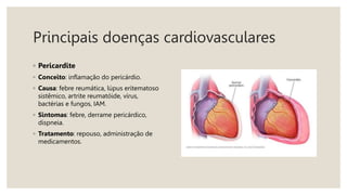 Principais doenças cardiovasculares
◦ Pericardite
◦ Conceito: inflamação do pericárdio.
◦ Causa: febre reumática, lúpus eritematoso
sistêmico, artrite reumatóide, vírus,
bactérias e fungos, IAM.
◦ Sintomas: febre, derrame pericárdico,
dispneia.
◦ Tratamento: repouso, administração de
medicamentos.
 