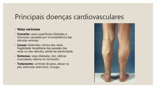 Principais doenças cardiovasculares
◦ Veias varicosas
◦ Conceito: veias superficiais dilatadas e
tortuosas causadas por incompetência das
válvulas venosas.
◦ Causas: distensão crônica das veias,
fragilidade hereditária das paredes das
veias ou das válvulas, perda da elasticidade.
◦ Sintomas: veias dilatadas, dor, cãibras
musculares, edema no tornozelo.
◦ Tratamento: controle de peso, elevar os
pés, estimular exercícios, cirurgia.
 