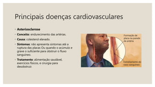 Principais doenças cardiovasculares
◦ Asteriosclerose
◦ Conceito: endurecimento das artérias.
◦ Causa: colesterol elevado.
◦ Sintomas: não apresenta sintomas até a
ruptura das placas Ou quando o acúmulo e
grave o suficiente para obstruir o fluxo
sanguíneo.
◦ Tratamento: alimentação saudável,
exercícios físicos, e cirurgia para
desobstruir.
 