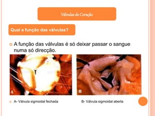  A função das válvulas é só deixar passar o sangue
numa só direcção.
 A- Válvula sigmoidal fechada B- Válvula sigmoidal aberta
Válvulas do Coração
Qual a função das válvulas?
 