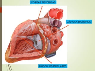 MÚSCULOS PAPILARES
VÁLVULA BICÚSPIDE
CORDAS TENDÍNEAS
 