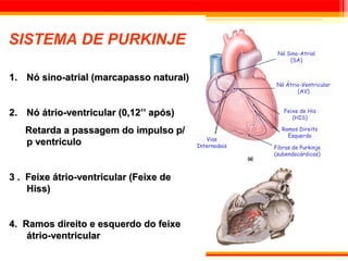 SISTEMA DE PURKINJE
                                                        Nó Sino-Atrial
                                                            (SA)


1. Nó sino-atrial (marcapasso natural)
                                                        Nó Átrio-Ventricular
                                                               (AV)


                                                          Feixe de His
2. Nó átrio-ventricular (0,12’’ após)                        (HIS)

   Retarda a passagem do impulso p/                       Ramos Direito
                                                            Esquerdo
                                            Vias
   p ventrículo                          Internodais   Fibras de Purkinje
                                                       (subendocárdicas)



3 . Feixe átrio-ventricular (Feixe de
    Hiss)


4. Ramos direito e esquerdo do feixe
    átrio-ventricular
 