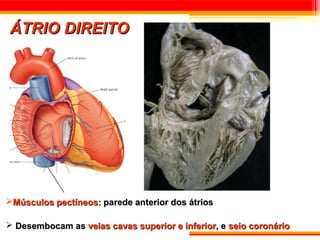 ÁTRIO DIREITO




Músculos pectíneos: parede anterior dos átrios

 Desembocam as veias cavas superior e inferior, e seio coronário
 