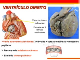 VENTRÍCULO DIREITO


                             Valva do tronco
                               pulmonar:

                              Formada por 3
                                 válvulas
                               semilunares




Valva atrioventricular direita: 3 válvulas + cordas tendíneas + músculos
papilares

 Presença de trabéculas cárneas

 Saída do tronco pulmonar
 