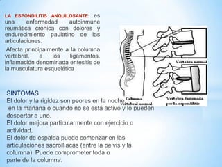 LA ESPONDILITIS ANQUILOSANTE: es
una enfermedad autoinmune
reumática crónica con dolores y
endurecimiento paulatino de las
articulaciones.
Afecta principalmente a la columna
vertebral, a los ligamentos,
inflamación denominada entesitis de
la musculatura esquelética
SINTOMAS
 