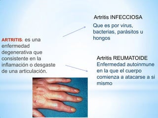 Artritis REUMATOIDE
Enfermedad autoinmune
en la que el cuerpo
comienza a atacarse a si
mismo
Artritis INFECCIOSA
Que es por virus,
bacterias, parásitos u
hongosARTRITIS: es una
enfermedad
degenerativa que
consistente en la
inflamación o desgaste
de una articulación.
 