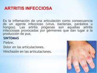 Es la inflamación de una articulación como consecuencia
de un agente infeccioso (virus, bacterias, parásitos u
hongos). Las artritis piógenas son aquellas artritis
infecciosas provocadas por gérmenes que dan lugar a la
producción de pus.
SINTOMAS
Fiebre.
Dolor en las articulaciones.
Hinchazón en las articulaciones.
ARTRITIS INFECCIOSA
 