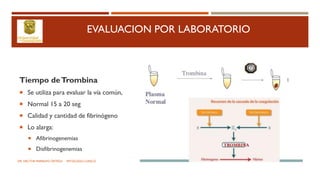 EVALUACION POR LABORATORIO
Tiempo deTrombina
 Se utiliza para evaluar la vía común,
 Normal 15 a 20 seg
 Calidad y cantidad de fibrinógeno
 Lo alarga:
 Afibrinogenemias
 Disfibrinogenemias
DR. HECTOR MARRUFO ORTEGA PATOLOGO CLINICO
 
