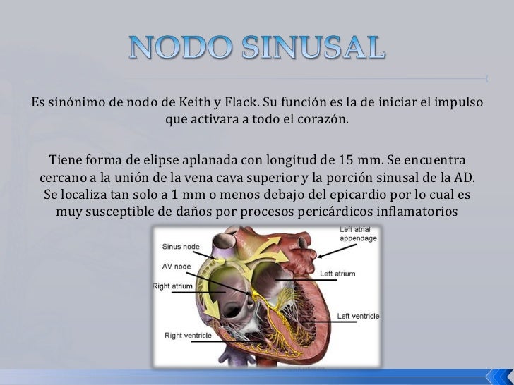 Sistema de conducción Sistema de conducción