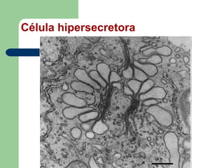 Célula hipersecretora
 