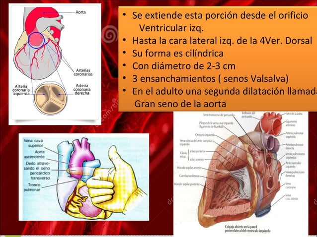 Qué Es El Cayado Aórtico _ Aneurisma aórtico: qué es, síntomas y ...