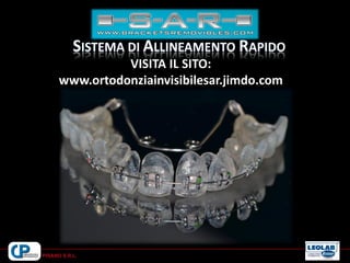 VISITA IL SITO:
www.ortodonziainvisibilesar.jimdo.com
 