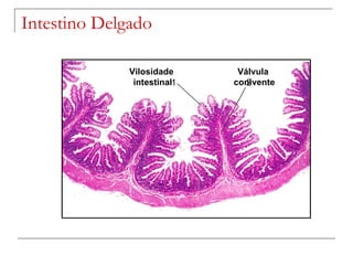 Intestino Delgado Vilosidade intestinal Válvula  conivente 1 2 