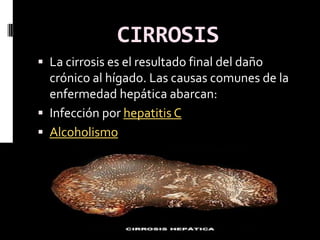 CIRROSIS
 La cirrosis es el resultado final del daño
  crónico al hígado. Las causas comunes de la
  enfermedad hepática abarcan:
 Infección por hepatitis C
 Alcoholismo
 