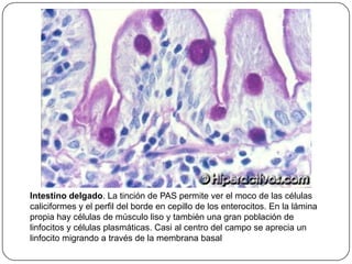 Intestino delgado. La tinción de PAS permite ver el moco de las células
caliciformes y el perfil del borde en cepillo de los enterocitos. En la lámina
propia hay células de músculo liso y también una gran población de
linfocitos y células plasmáticas. Casi al centro del campo se aprecia un
linfocito migrando a través de la membrana basal
 