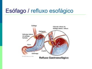 Esófago / refluxo esofágico

 