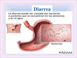 Diarrea 
 