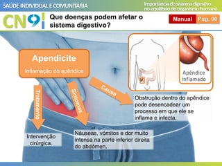 CN
SAÚDEINDIVIDUAL ECOMUNITÁRIA Importânciadosistemadigestivo
noequilíbriodoorganismohumano
Que doenças podem afetar o
sistema digestivo?
Manual Pág. 90
Apendicite
Inflamação do apêndice
Obstrução dentro do apêndice
pode desencadear um
processo em que ele se
inflama e infecta.
Náuseas, vómitos e dor muito
intensa na parte inferior direita
do abdómen.
Intervenção
cirúrgica.
Tratamento
 
