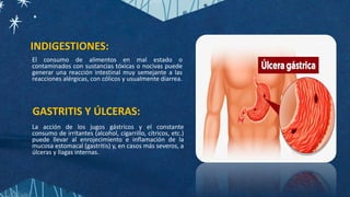 INDIGESTIONES:
GASTRITIS Y ÚLCERAS:
El consumo de alimentos en mal estado o
contaminados con sustancias tóxicas o nocivas puede
generar una reacción intestinal muy semejante a las
reacciones alérgicas, con cólicos y usualmente diarrea.
La acción de los jugos gástricos y el constante
consumo de irritantes (alcohol, cigarrillo, cítricos, etc.)
puede llevar al enrojecimiento e inflamación de la
mucosa estomacal (gastritis) y, en casos más severos, a
úlceras y llagas internas.
 