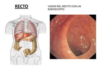 RECTO

VISION REL RECTO CON UN
ENDOSCOPIO

 