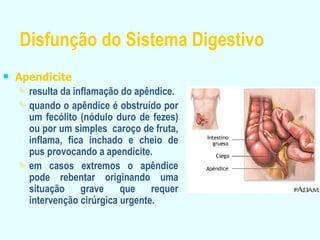 Disfunção do Sistema Digestivo Apendicite   resulta da inflamação do apêndice. quando o apêndice é obstruído por um fecólito (nódulo duro de fezes) ou por um simples  caroço de fruta, inflama, fica inchado e cheio de pus provocando a apendicite. em casos extremos o apêndice pode rebentar originando uma situação grave que requer intervenção cirúrgica urgente. 
