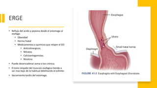 ERGE
• Reflujo del acido y pepsina desde el estomago al
esofago
• Obesidad
• Hernia hiatal
• Medicamentos o quimicos que relajen el EEI
• Anticolinergicos.
• Nitratos
• Calcioantagonistas.
• Nicotina
• Puede desencadenar asma o tos crónica.
• El tono relajado del musculo esofagico tiende a
ser mas bajo de lo habitual debilitando el esfinter.
• Vaciamiento tardío del estomago.
 